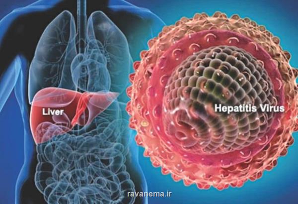 ایران تا 1410 از هپاتیت C پاک می شود